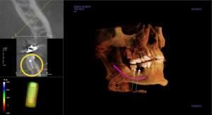 dental ct scan
