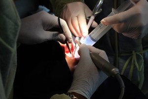 dental training at AAID maxicourse